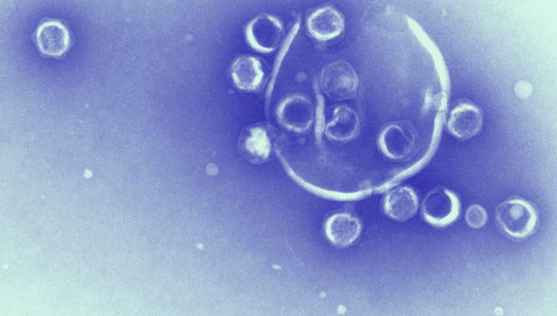 Viruses are the most abundant biological units on earth / Yaiza M. Castillo Viruses are the most abundant biological units on earth / Yaiza M. Castillo