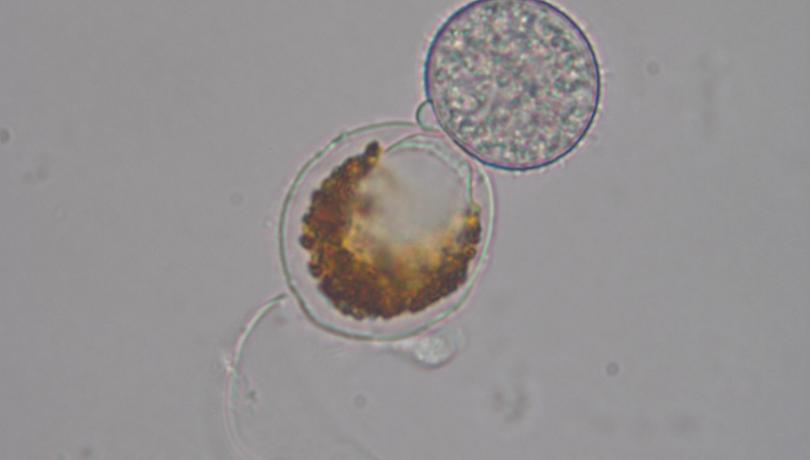 Dinoflagellate cell infected by the chytrid ectoparasite Ericiomyces syringoforeus / Albert Reñé (ICM-CSIC)