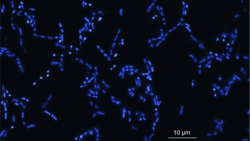 Epifluorescence microscopy images showing cultivated marine bacteria with DAPI fluorescence / ICM-CSIC