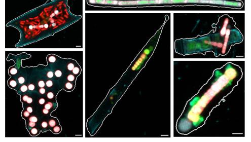Merged confocal channel images of the many forms of open ocean cyanobacterial diazotrophs / R.A. Foster.